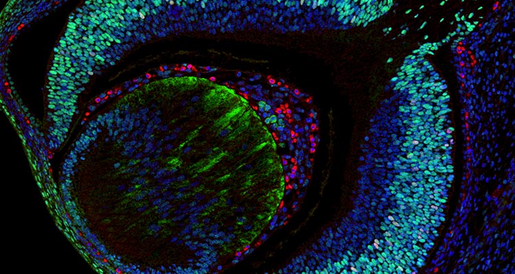 Image of a section through the eye of an E14.5 mouse embryo immunolabeled for stem cells (green), oligodendrocytes (red) and nuclei (blue). Image acquired by Dipankar Dutta on a Leica SP5